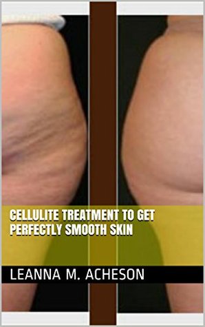 Read Cellulite Treatment to Get Perfectly Smooth Skin - Leanna M. Acheson file in ePub