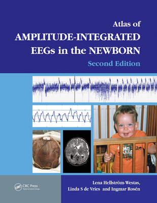 Full Download An Atlas of Amplitude-Integrated Eegs in the Newborn - Lena Hellstrom-Westas file in PDF